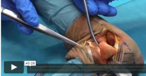 Read more about the article Videos aus der Unfallchirurgie